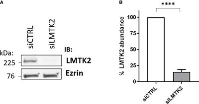 Differential Gene Expression Analysis Reveals Global LMTK2 Regulatory Network and Its Role in TGF-β1 Signaling